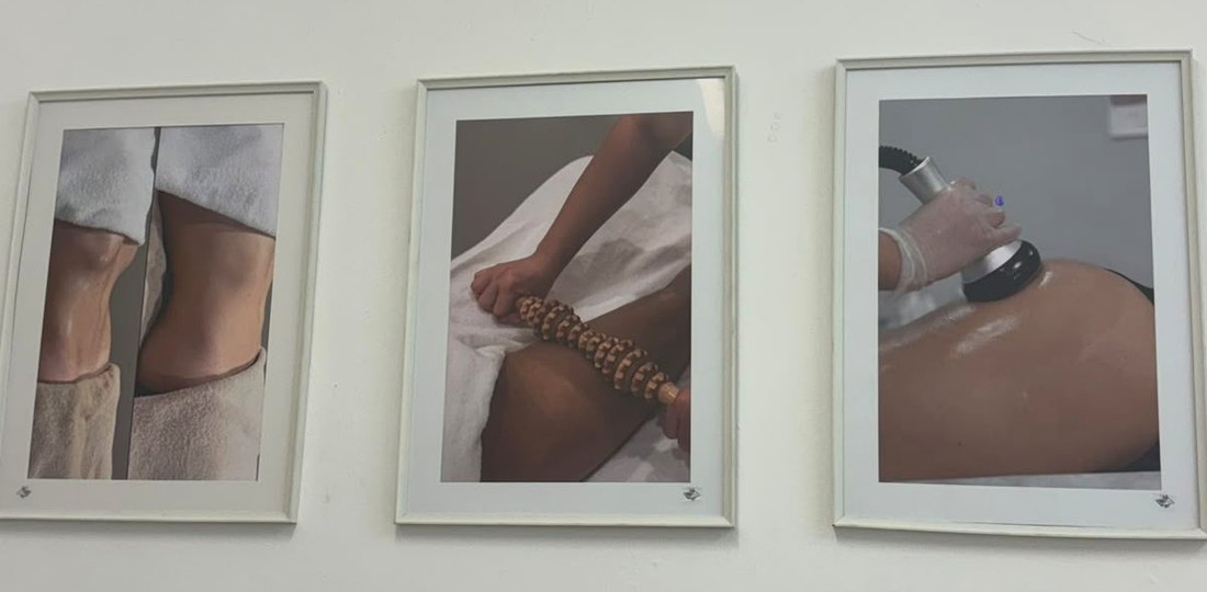 Wood Therapy treatment room at J Artistry Clinic in Coventry